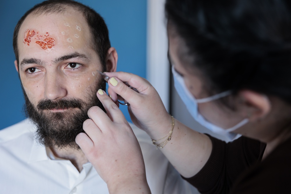 dermatologist in hanamkonda